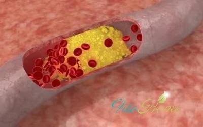 Сенны листья для похудения отзывы