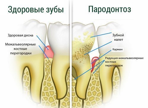 Как лечить поджелудочную железу в домашних условиях народными Как лечить поджелудочную железу в домашних условиях народными