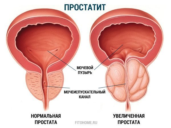 повысить потенцию с помощью препаратов