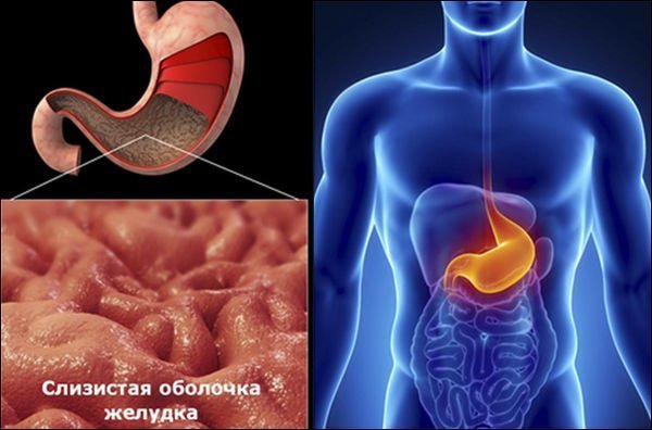 Что такое норовирус и как его лечить у детей