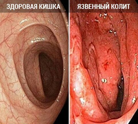 Санатории чехии лечение астмы