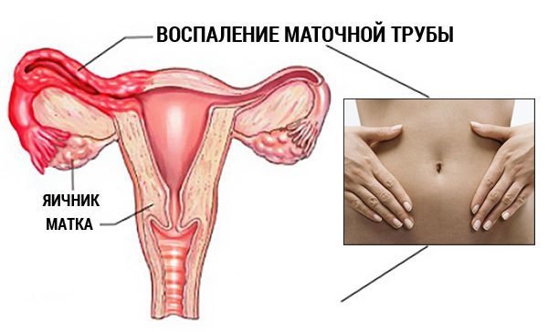 Дерматит на ногах лечение