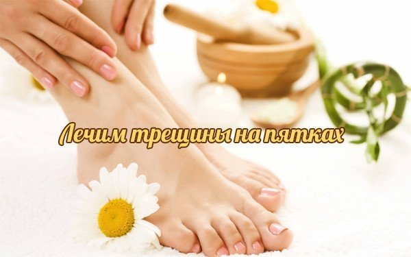 Трещины на ногах причины лечение в домашних условиях 362
