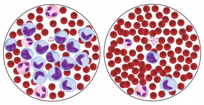 Повышены лимфоциты в крови что это значит у взрослого