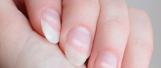 Почему появились белые пятна на ногтях?