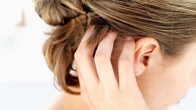Псориаз на голове начальная стадия — чем лечить псориаз?