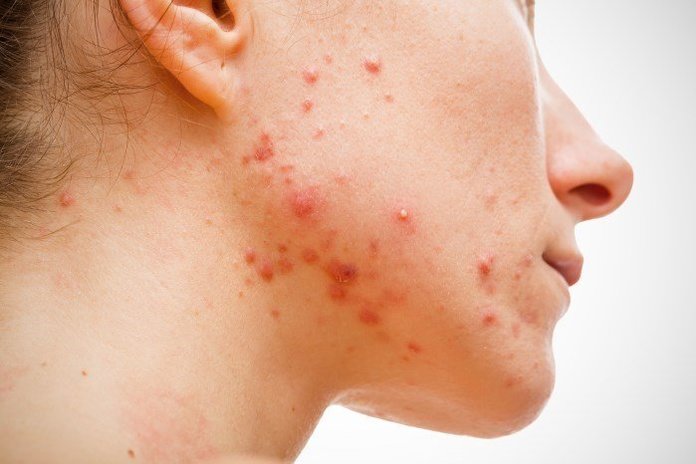 atop-derm