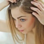 Псориаз на голове: симптомы и лечение